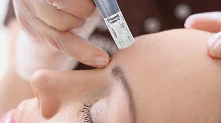 Microneedling skin texture treatment